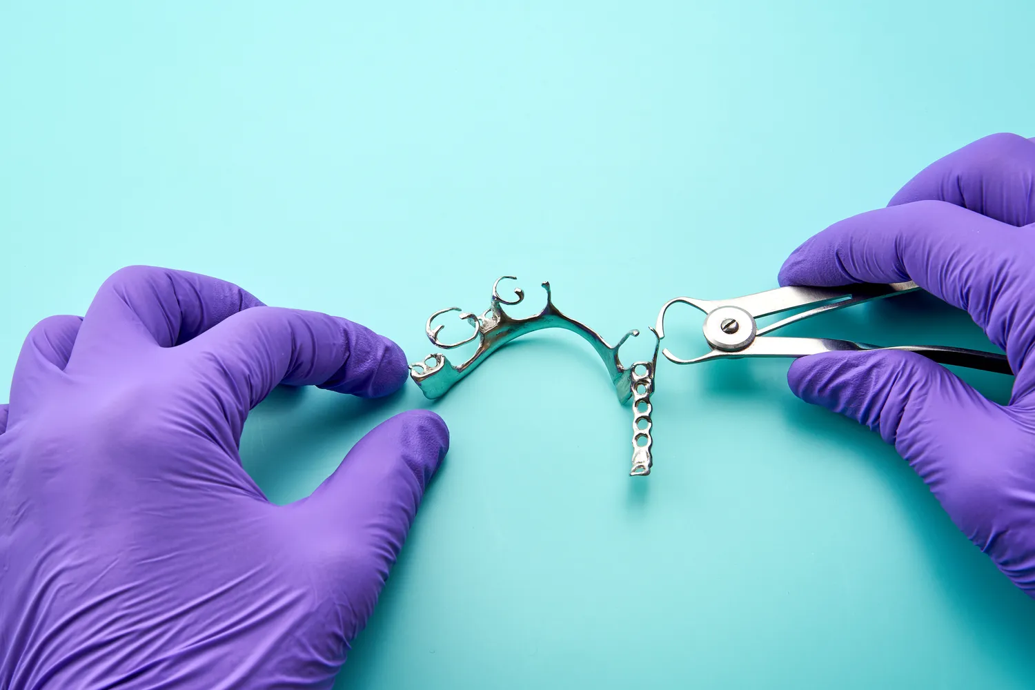 Czy leczenie kanałowe boli z znieczuleniem?