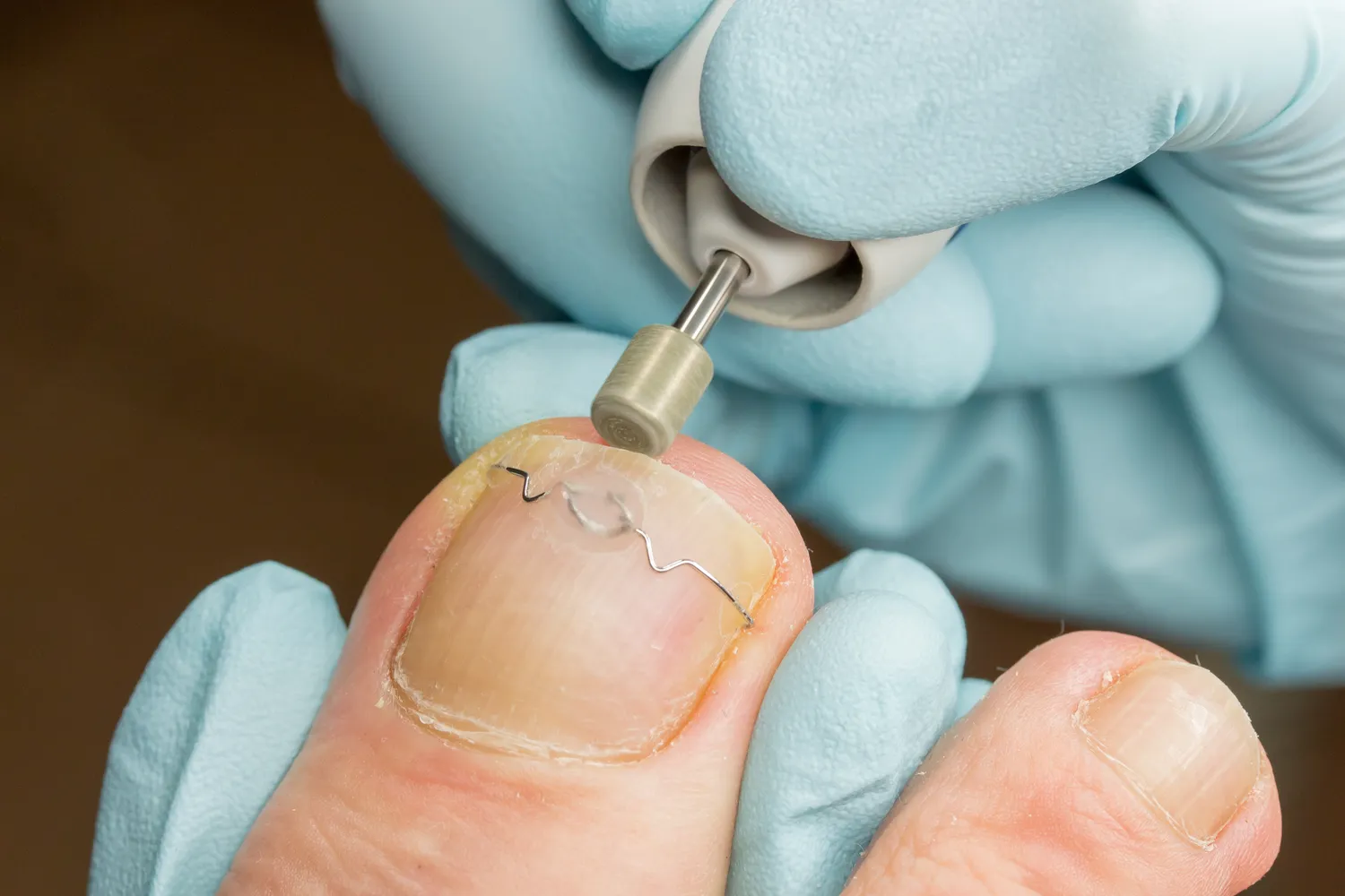 Czym jest podologia oraz czym dokładnie zajmuje się podolog?